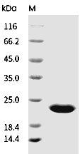FGF-21 Protein, Human, Recombinant  (Low Endotoxin)