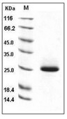 Lipocalin-2/LCN2 Protein, Mouse, Recombinant (His)