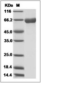 Influenza A H3N2 (A/Hong Kong/1/1968) Hemagglutinin/HA Protein (aa 1-530, His)