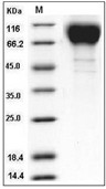 HIV-1 (group M, subtype CRF07_BC) gp120 Protein (His)