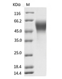 MICA Protein, Human, Recombinant (His), MICA*018