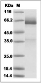 Glypican 3/GPC3 Protein, Mouse, Recombinant (His)