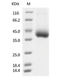 CD122/IL2RB Protein, Cynomolgus/Rhesus, Recombinant (His)