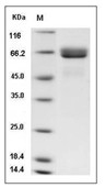 Alkaline phosphatase/ALPI Protein, Human, Recombinant (His)