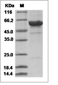 Influenza A H5N6 (A/Sichuan/26221/2014) Hemagglutinin/HA Protein (His)