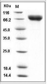 Influenza A H5N1 (A/Vietnam/1194/2004) Hemagglutinin/HA Protein (RERRRKKR to TETR, HA1+HA2, uncleaved, His)