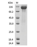 TIE2 Protein, Human, Recombinant (His)
