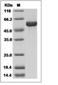 Influenza A H3N2 (A/Aichi/2/1968) Nucleoprotein/NP Protein (His)