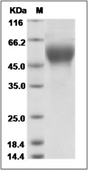 Influenza A H9N2 (A/Hong Kong/3239/2008) Hemagglutinin/HA1 Protein (His)