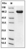 DC-SIGN Protein, Human, Recombinant (hFc)
