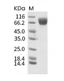 c-Kit/CD117 Protein, Human, Recombinant (His)