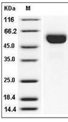 Influenza A H3N2 (A/Aichi/2/1968) Hemagglutinin/HA1 Protein (His)
