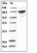 GM-CSFR alpha Protein, Human, Recombinant (His)
