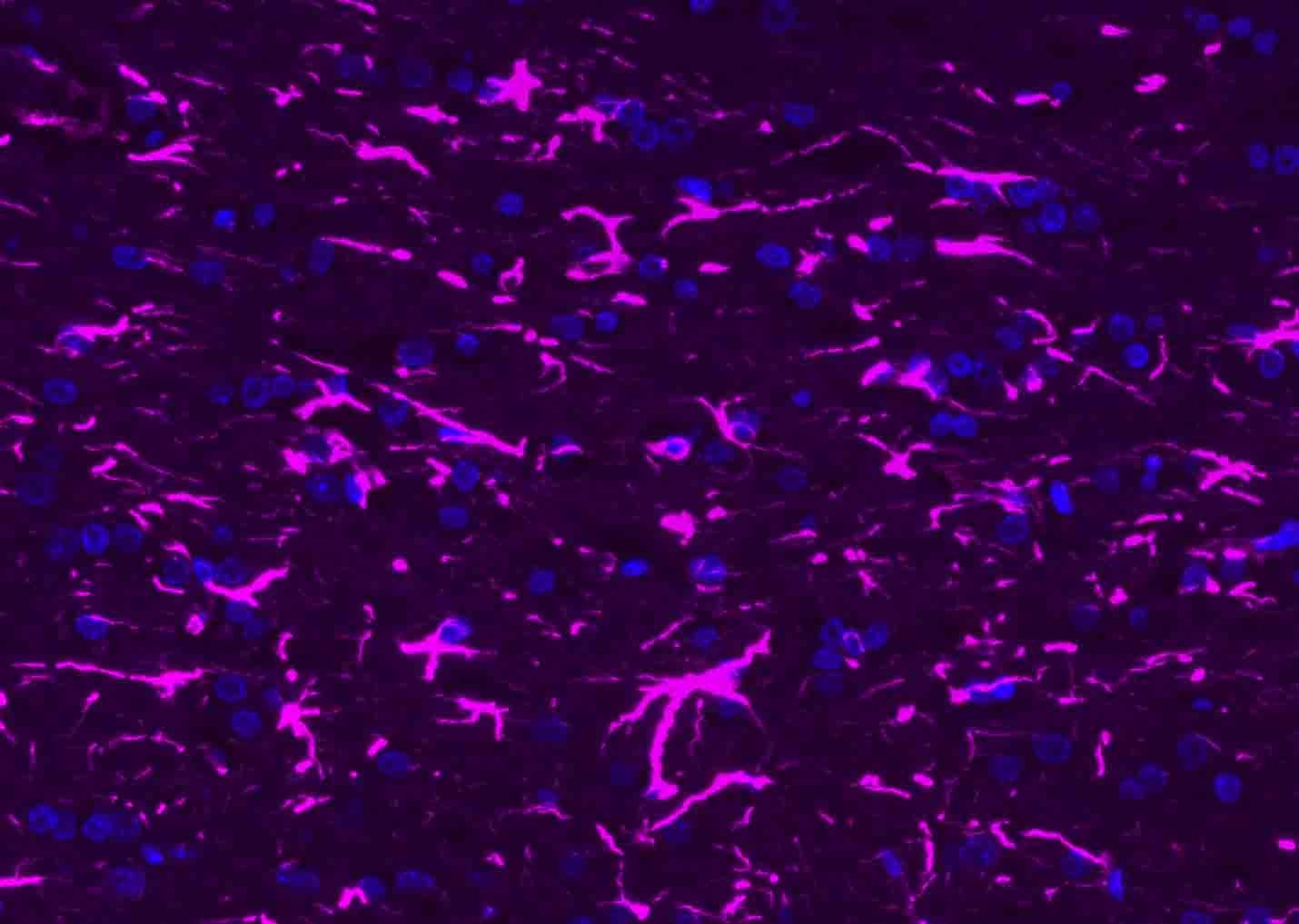 Donkey Anti-Rabbit IgG H&L Secondary Antibody-AF647