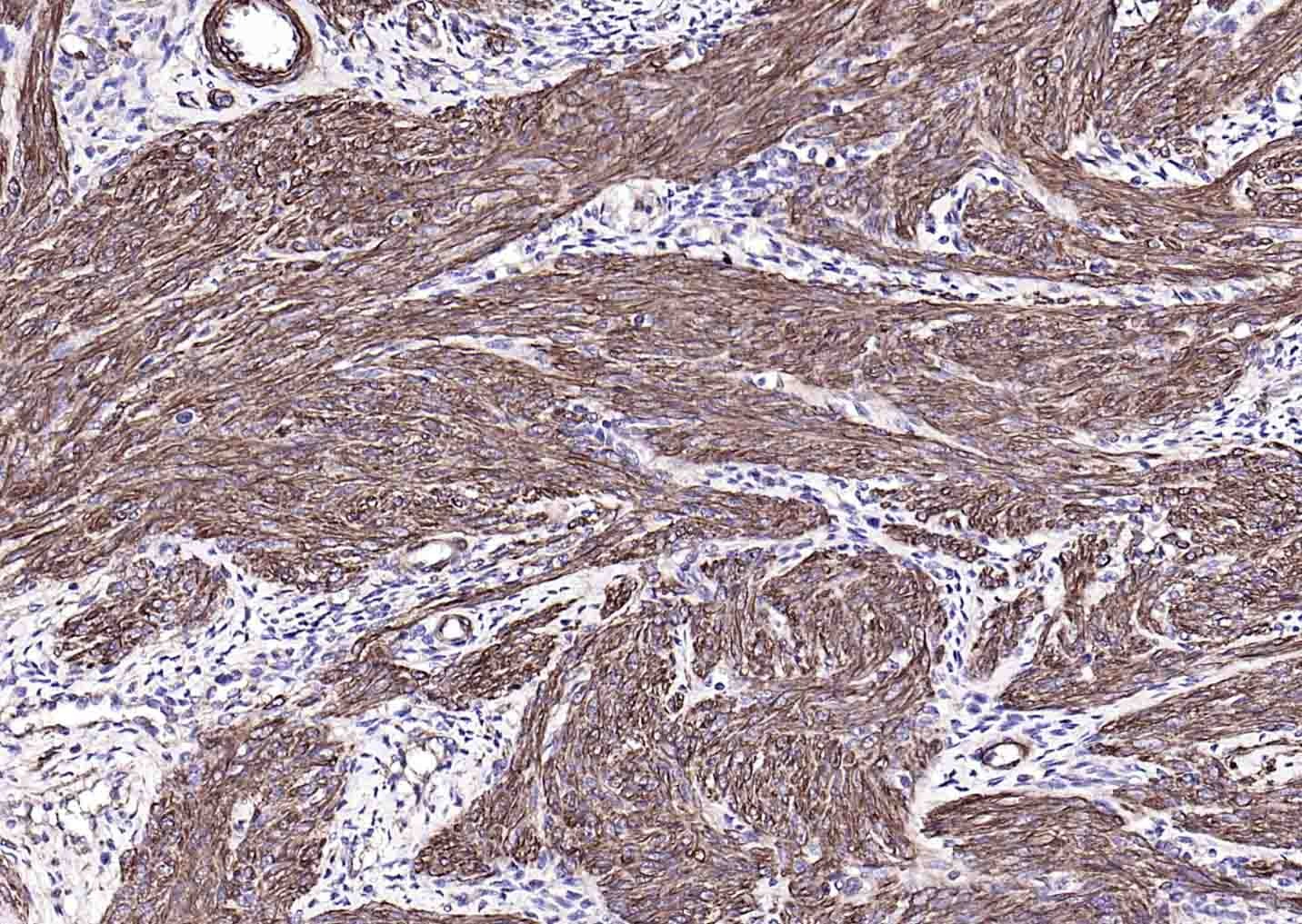 Goat Anti-Mouse IgG H&L Secondary Antibody-HRP