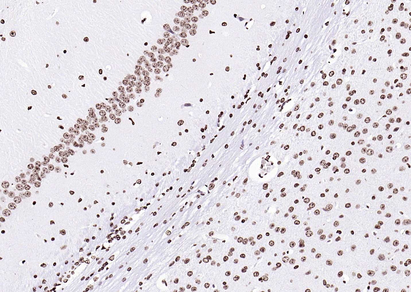Goat Anti-Rabbit IgG H&L Secondary Antibody-HRP