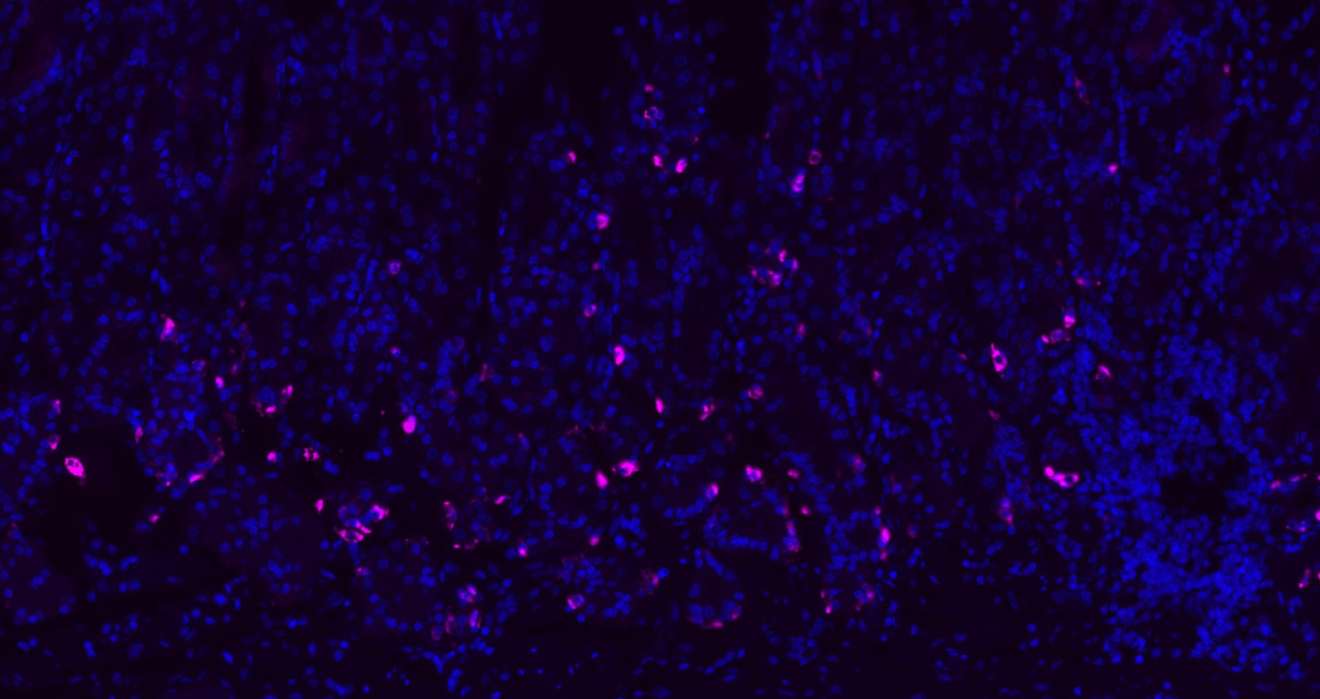 Donkey Anti-Rabbit IgG H&L Secondary Antibody-Cy5