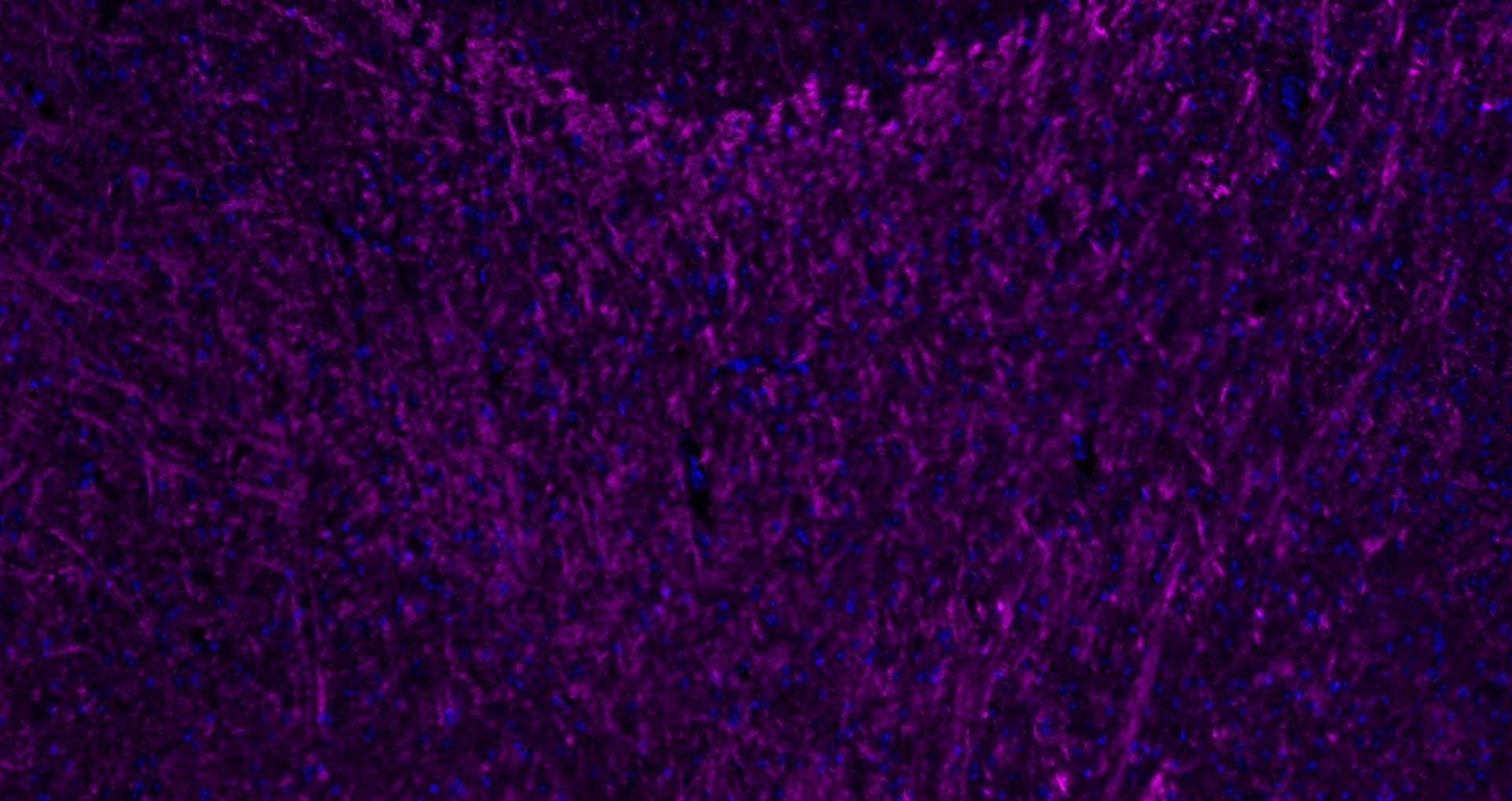 Donkey Anti-Rabbit IgG H&L Secondary Antibody-Cy5