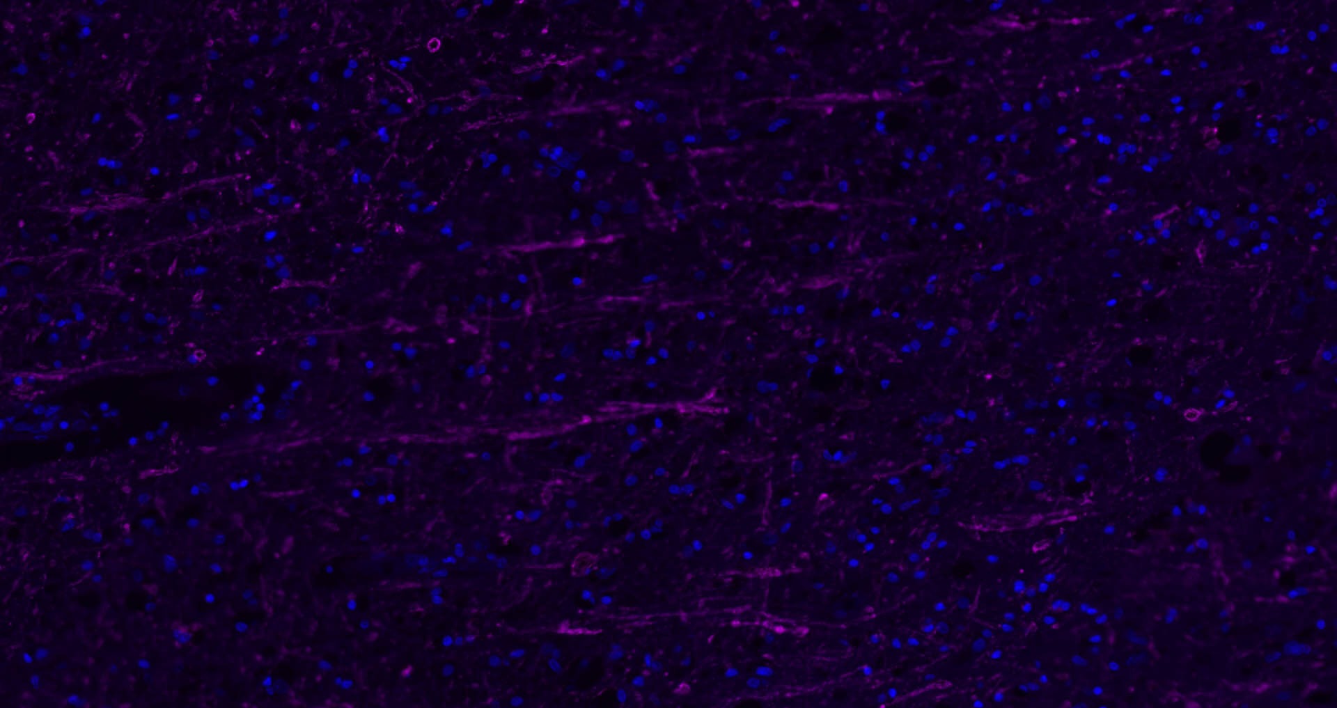 Donkey Anti-Rabbit IgG H&L Secondary Antibody-Cy5
