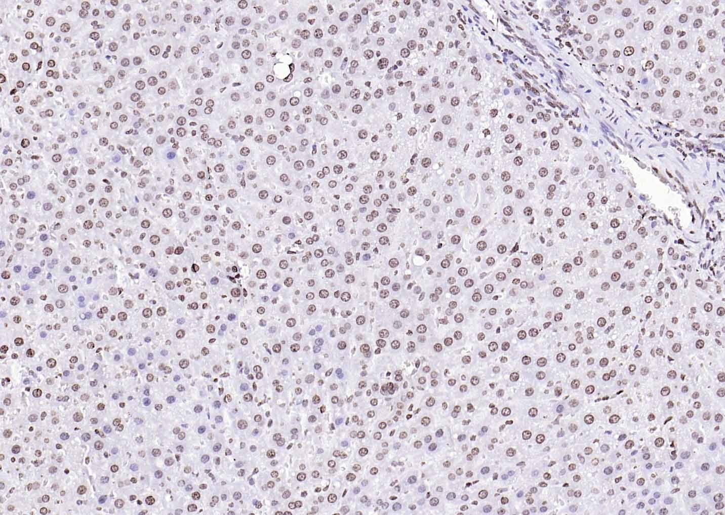 Goat Anti-Rabbit IgG H&L Secondary Antibody-HRP