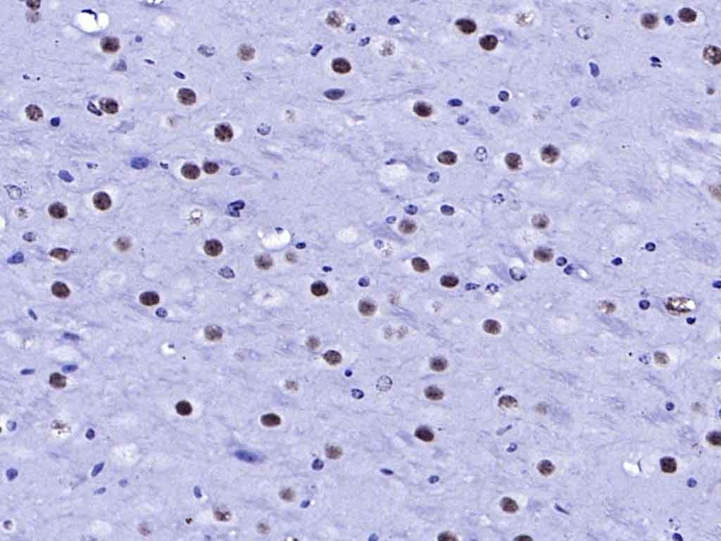 AffiniPure Goat Anti-Rabbit IgG H&L Secondary Antibody-HRP