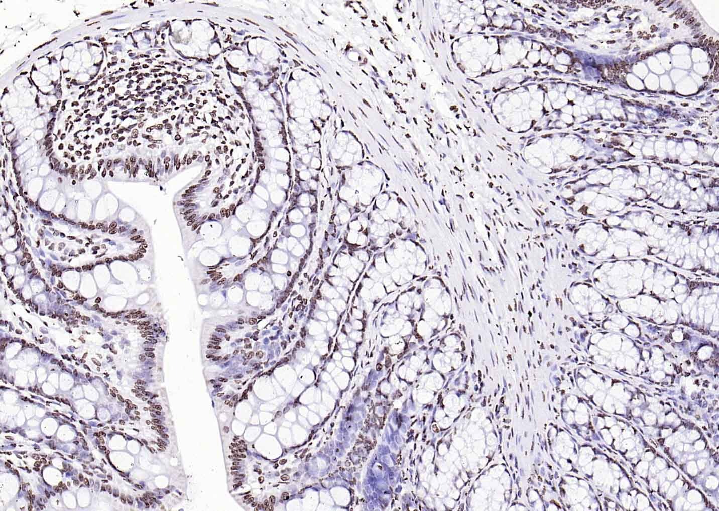 Goat Anti-Rabbit IgG H&L Secondary Antibody-HRP