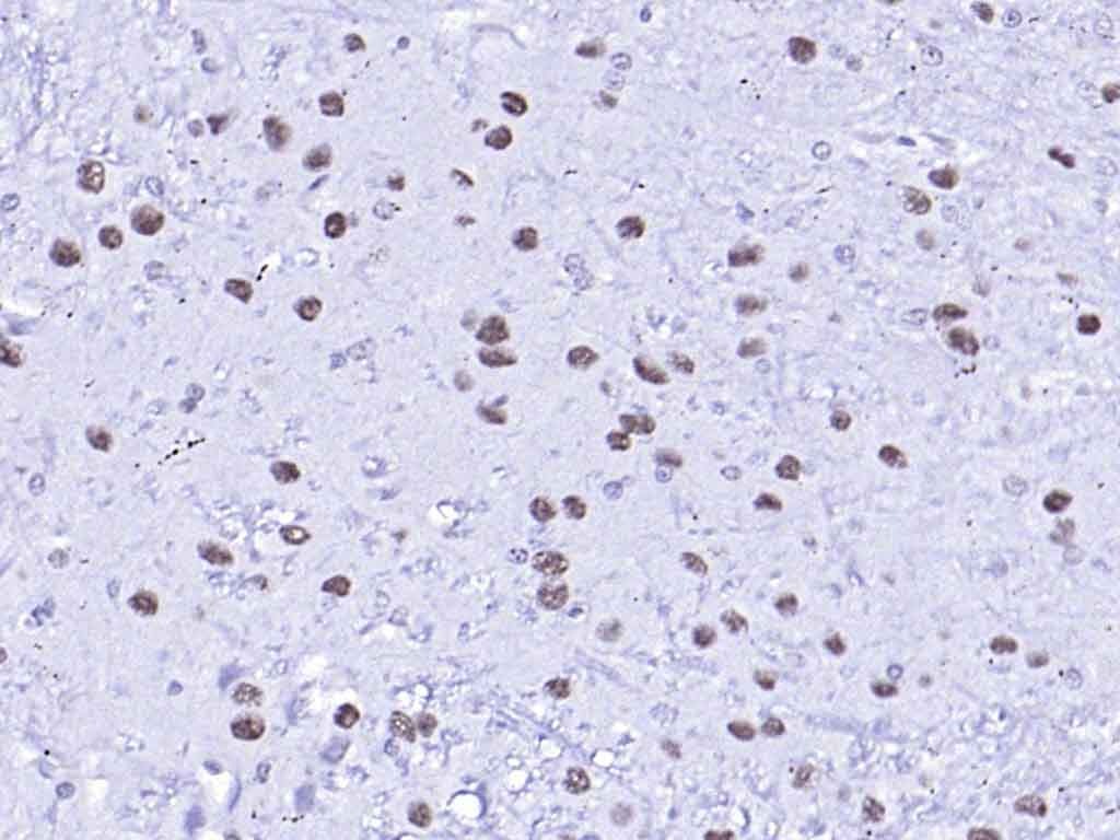 AffiniPure Goat Anti-Rabbit IgG H&L Secondary Antibody-HRP