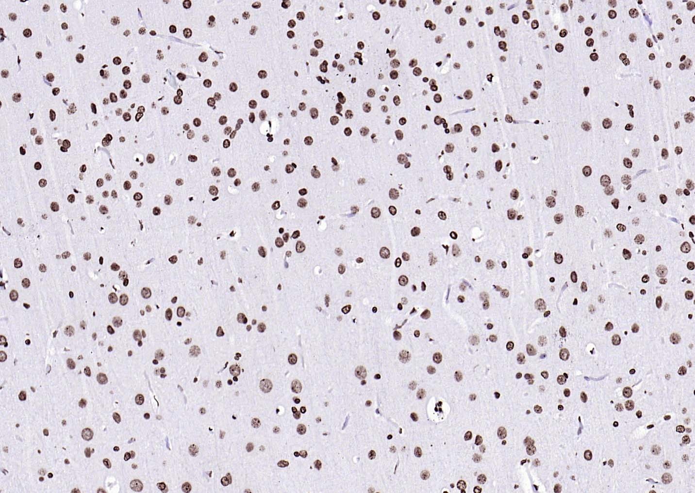 Goat Anti-Rabbit IgG H&L Secondary Antibody-HRP