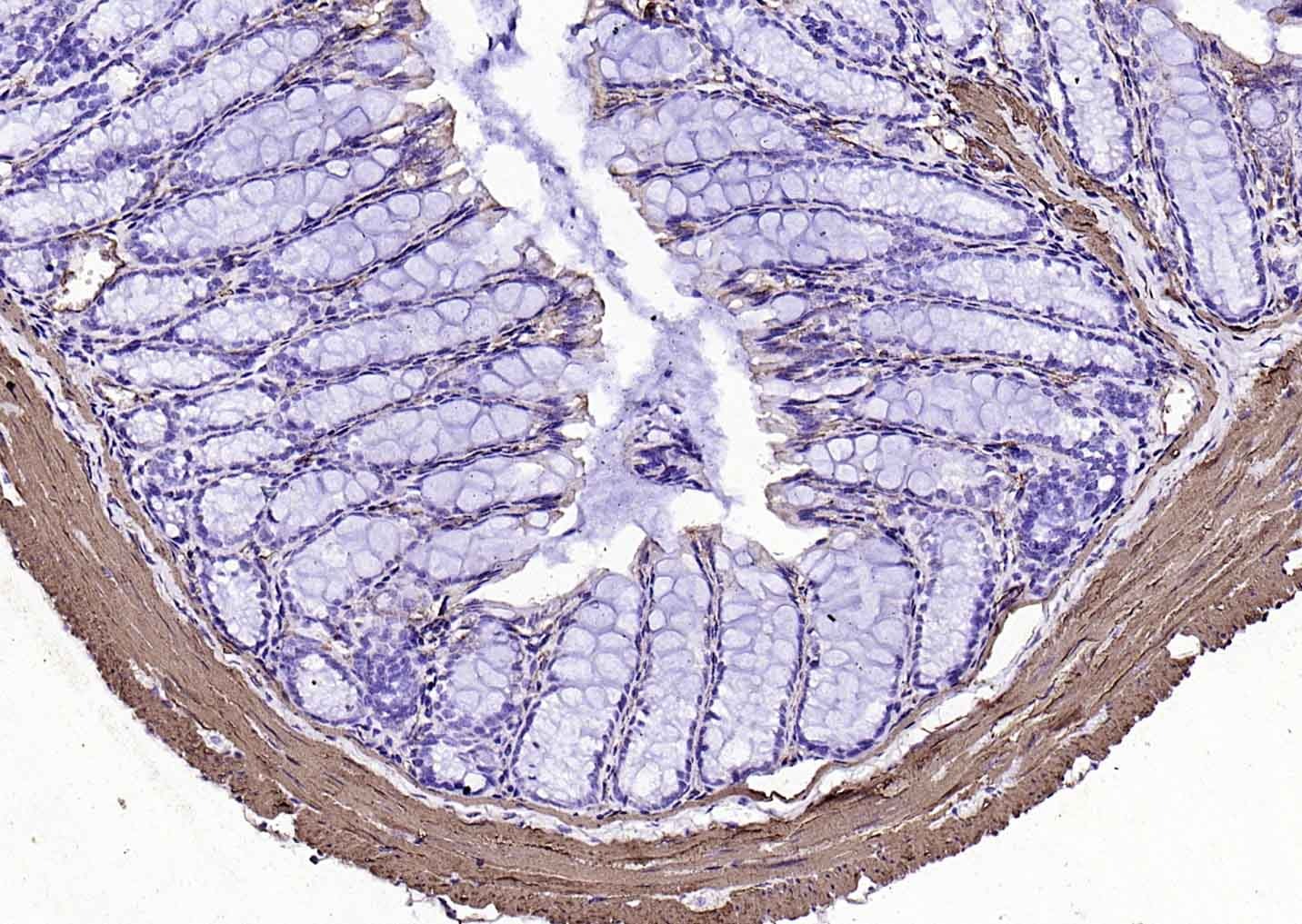 Goat Anti-Mouse IgG H&L Secondary Antibody-HRP