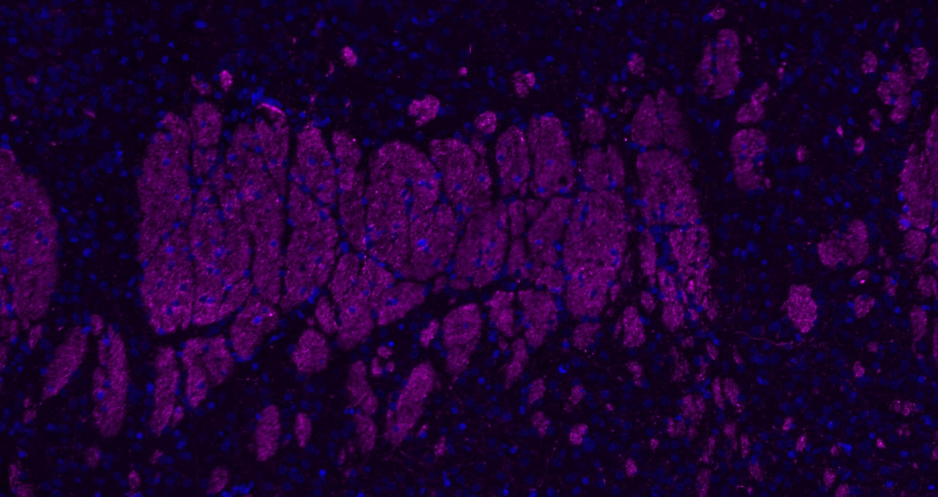 Donkey Anti-Rabbit IgG H&L Secondary Antibody-Cy5
