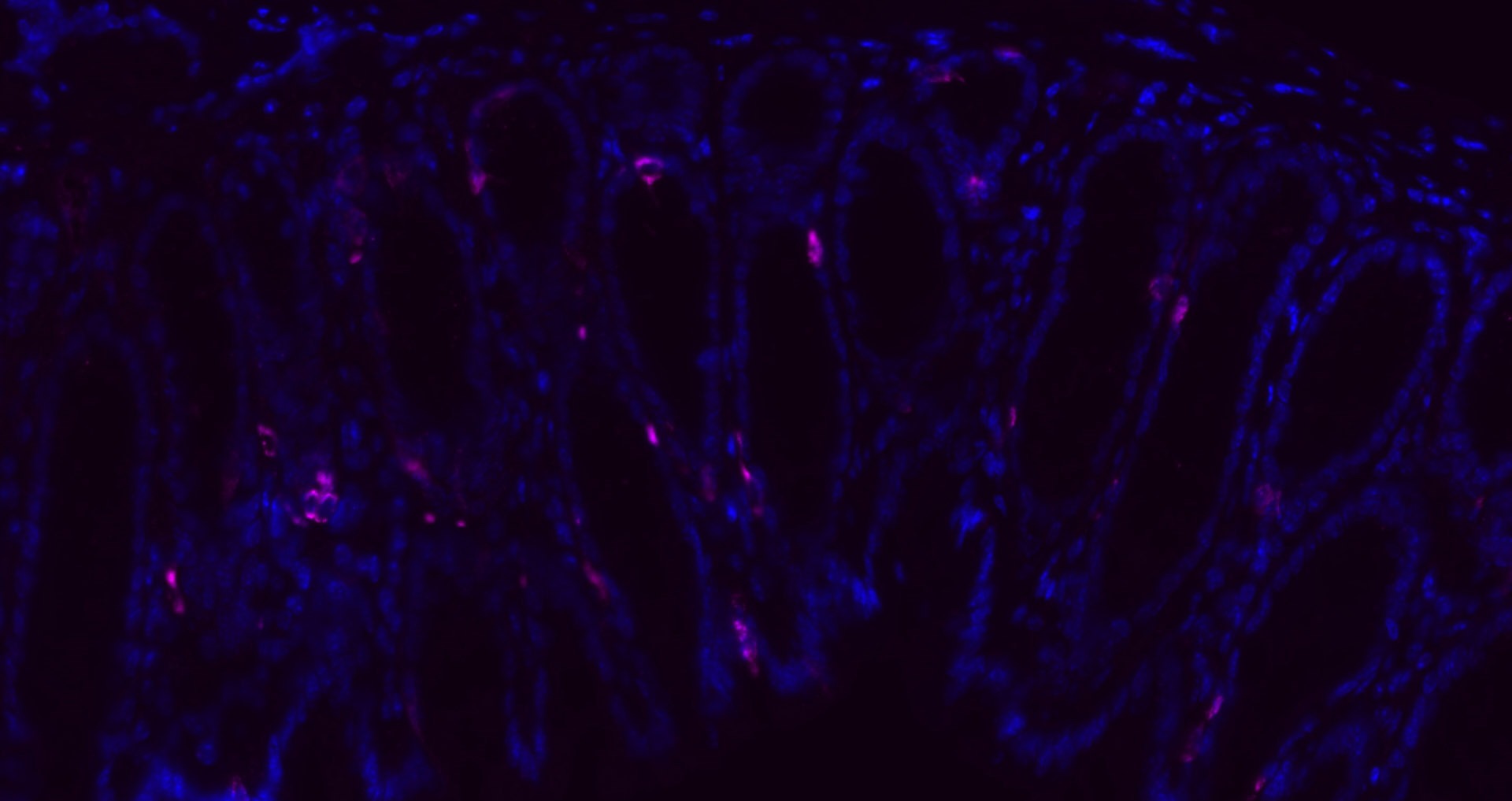Donkey Anti-Rabbit IgG H&L Secondary Antibody-Cy5