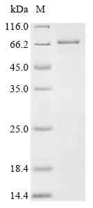 THRB Protein, Human, Recombinant (His & SUMO)
