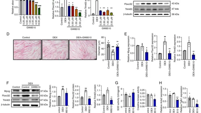 TargetMol信号通路——Dexamethasone（Cat. No. T1076,CAS 50-02-2），精准打击炎症因子