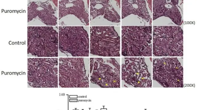 TargetMol天然产物——Puromycin dihydrochloride（Cat. No. T2219, Cas. 58-58-2），新生肽链标记专家