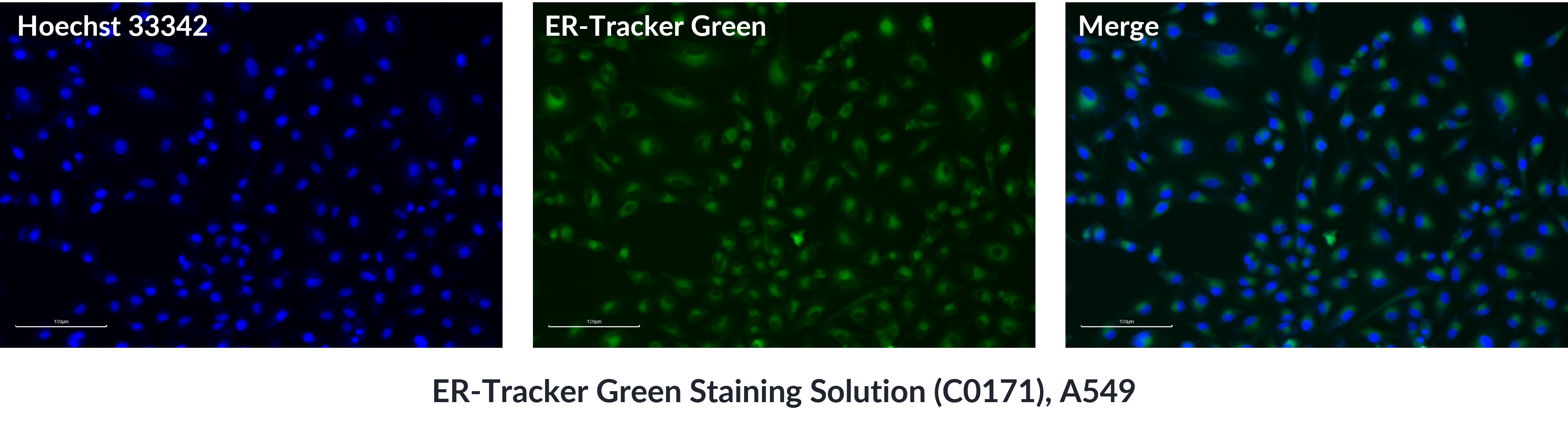  ER-Tracker Green Staining Solution