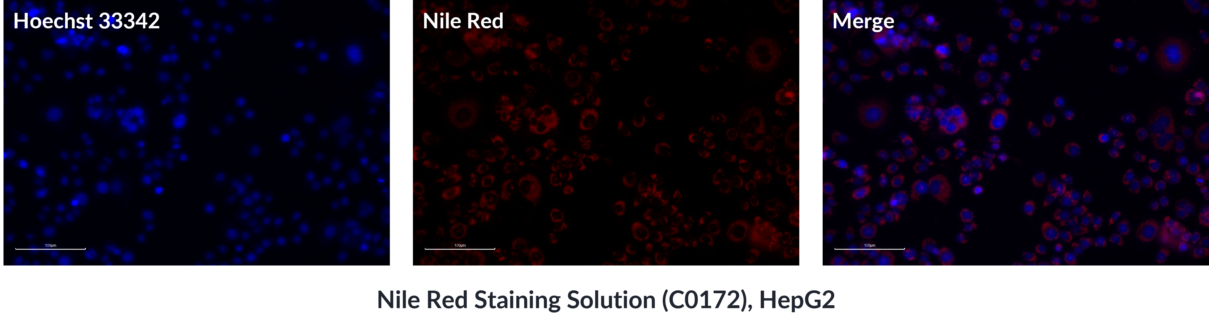  Nile Red Staining Solution