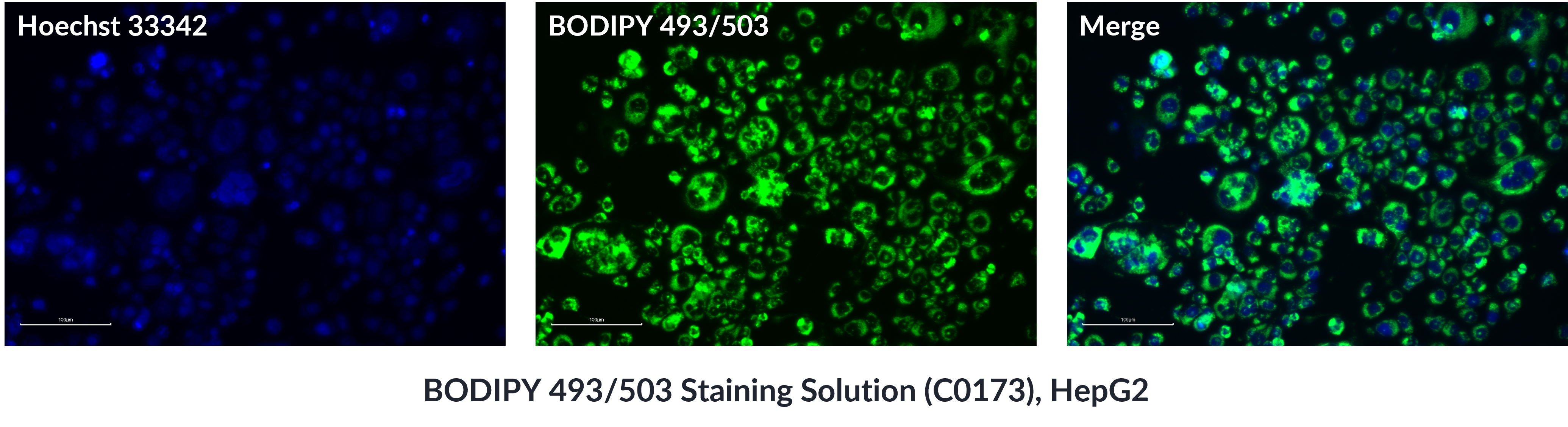  BODIPY 493/503 Staining Solution