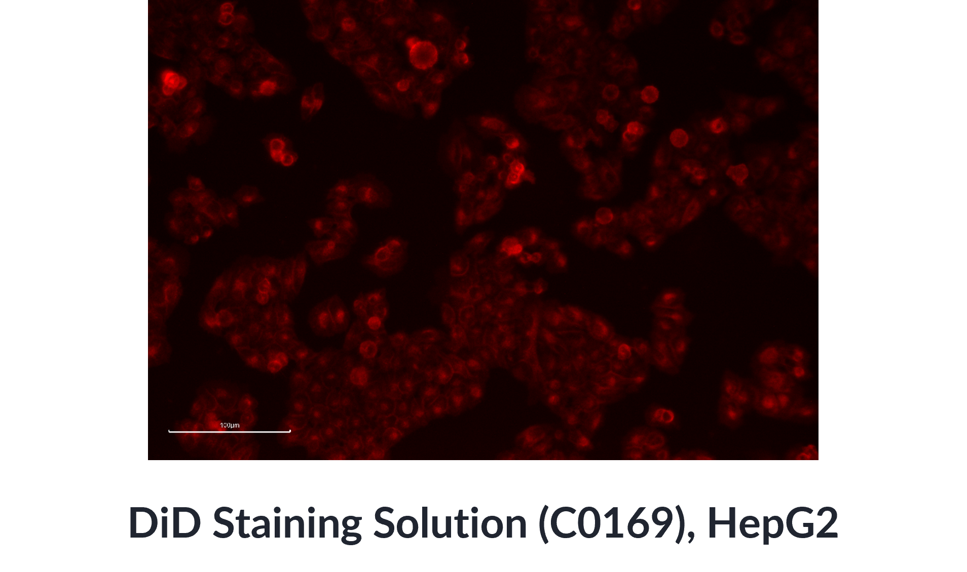  DiD Staining Solution