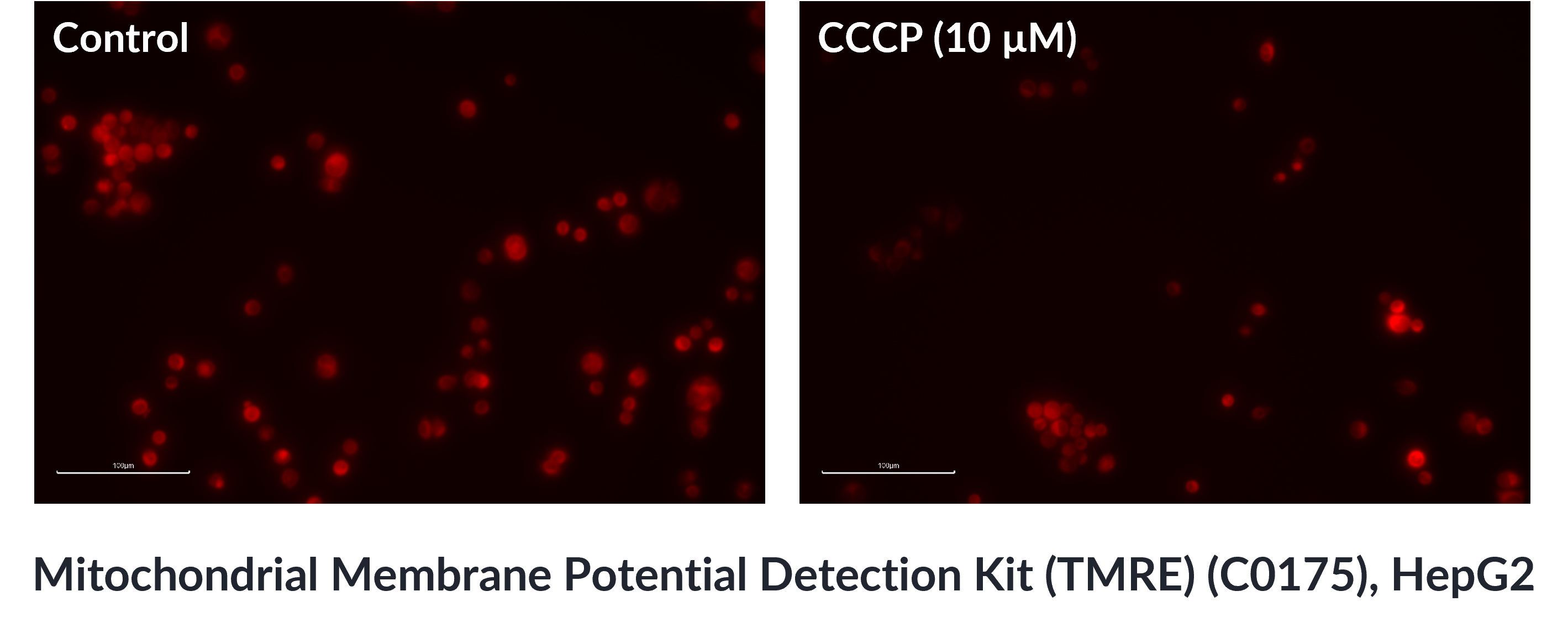  Mitochondrial Membrane Potential Detection Kit (TMRE)