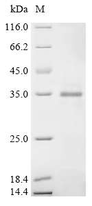 PTPRZ1 Protein, Human, Recombinant (His)