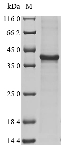 Plasminogen Protein, Human, Recombinant (His)