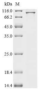 BCL6 Protein, Human, Recombinant (His)