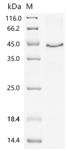 Wnt5a Protein, Human, Recombinant (His)