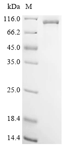 DDX1 Protein, Human, Recombinant (His & Myc)
