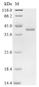 HIF1AN Protein, Human, Recombinant (His)