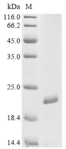 DIP2A Protein, Human, Recombinant (His)