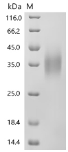 GCGR Protein, Human, Recombinant (His & Myc)